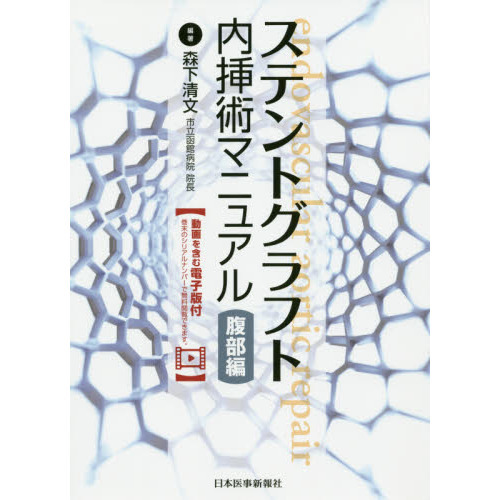 ステントグラフト内挿術マニュアル 胸部編-