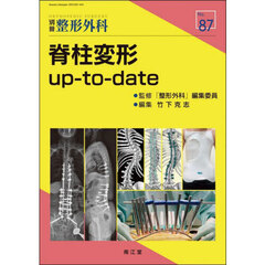 脊柱変形up‐to‐date