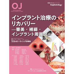 インプラント治療のリカバリー