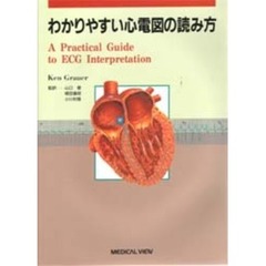 わかりやすい心電図の読み方