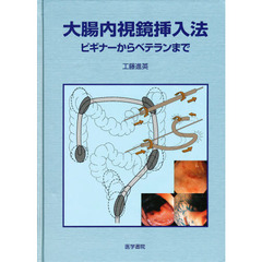 大腸内視鏡挿入 大腸内視鏡挿入の検索結果 - 通販｜セブンネットショッピング