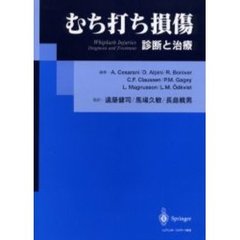 むち打ち損傷　診断と治療