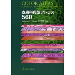 皮膚科典型アトラス５６０