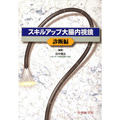 スキルアップ大腸内視鏡　診断編