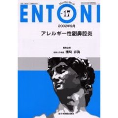ＥＮＴＯＮＩ　Ｍｏｎｔｈｌｙ　ｂｏｏｋ　Ｎｏ．１７（２００２年９月）　アレルギー性副鼻腔炎