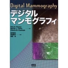 デジタルマンモグラフィ