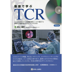 動画で学ぶＴＣＲ　ＳＳＣＩとＲｏＢＥＥＭで子宮筋腫治療はここまで進化する　新時代子宮鏡手術のＧＯＬＤ　ＳＴＡＮＤＡＲＤ