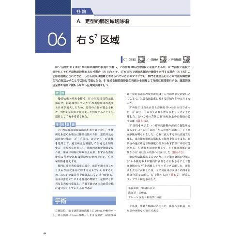 胸腔鏡下肺区域切除術のすべて 3DCT画像と動画でコツが