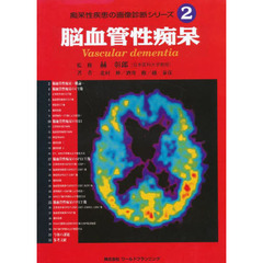 痴呆性疾患の画像診断シリーズ　２　脳血管性痴呆