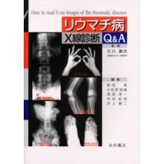 リウマチ病Ｘ線診断Ｑ＆Ａ