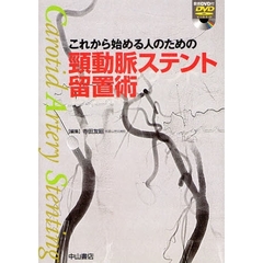 これから始める人のための頚動脈ステント留置術