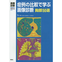症例の比較で学ぶ画像診断胸部５０選