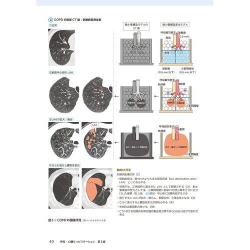 呼吸・心臓リハビリテーション 疾患ごとに最適なリハの手技と