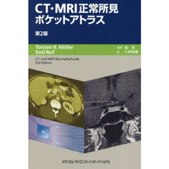 ＣＴ・ＭＲＩ正常所見ポケットアトラス　第２版