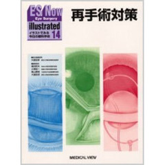 ＥＳ　ｎｏｗ　ｉｌｌｕｓｔｒａｔｅｄ　イラストでみる今日の眼科手術　１４　再手術対策