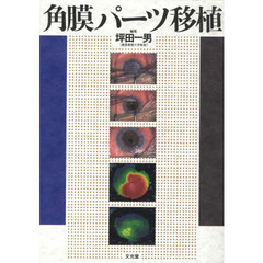 60％OFF】 角膜移植ガイダンス―適応から術後管理まで 坪田 一男 - 本