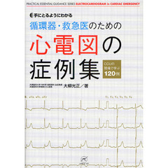 手にとるようにわかる循環器・救急医のための心電図の症例集　ＣＣＵの現場で学ぶ１２０例