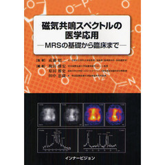 磁気共鳴スペクトルの医学応用　ＭＲＳの基礎から臨床まで