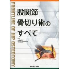股関節骨切り術のすべて