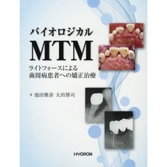 バイオロジカルＭＴＭ　ライトフォースによる歯周病患者への矯正治療