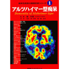 痴呆性疾患の画像診断シリーズ　１　アルツハイマー型痴呆