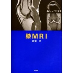 膝ＭＲＩ