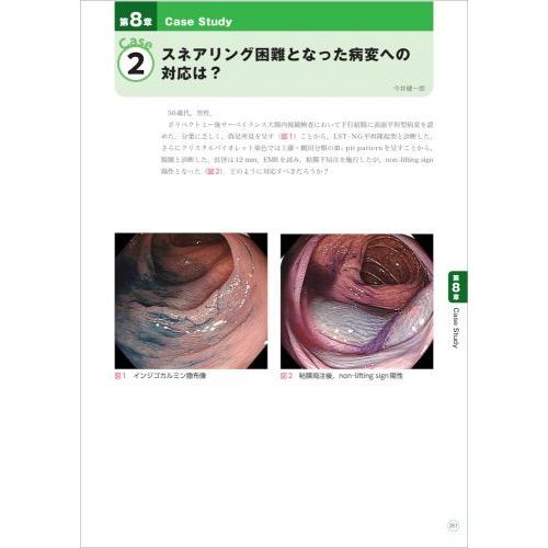 大腸ＥＭＲ・ＥＳＤの基本とコツ　エキスパートならではの治療手技・戦略を伝授