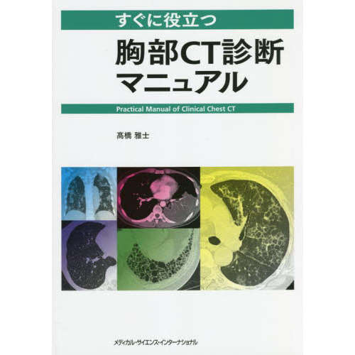 すぐに役立つ胸部CT診断マニュアル 通販｜セブンネットショッピング