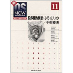 股関節疾患（小児・成人）の手術療法