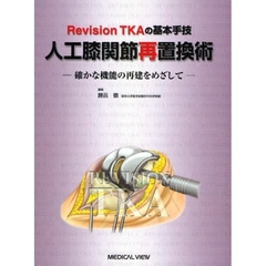 人工膝関節再置換術　Ｒｅｖｉｓｉｏｎ　ＴＫＡの基本手技　確かな機能の再建をめざして