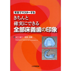 写真でマスターするきちんと確実にできる全部床義歯の印象