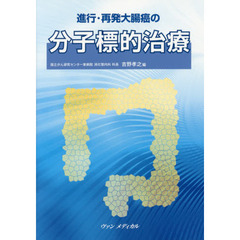 進行・再発大腸癌の分子標的治療