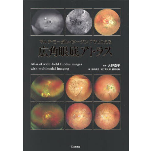 マルチモーダルイメージングでとらえる広角眼底アトラス マルチモーダルイメージングでとらえる広角眼底アトラス 通販