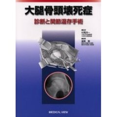 大腿骨頭壊死症　診断と関節温存手術