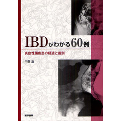 ＩＢＤがわかる６０例　炎症性腸疾患の経過と鑑別