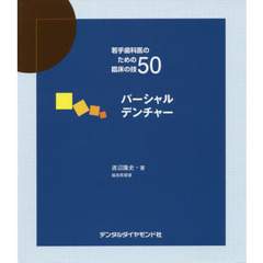 パーシャルデンチャー