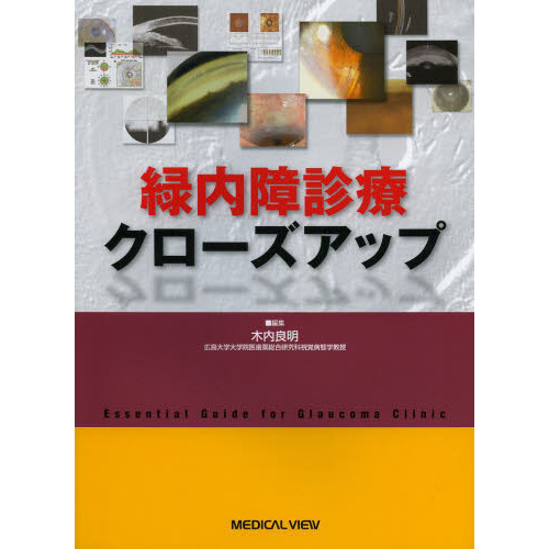 緑内障診療クローズアップ 緑内障診療クローズアップ 通販｜セブンネットショッピング