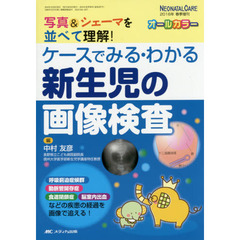 ケースでみる・わかる新生児の画像検査　写真＆シェーマを並べて理解！　オールカラー