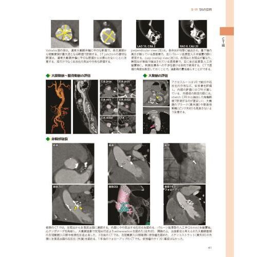 トップ mri cd 自宅